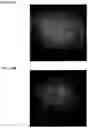 Fig. 32 - Methods of using PDX1-positive pancreatic endoderm cells and endocrine precursor cells