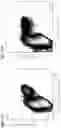 Fig. 34 - Methods of using PDX1-positive pancreatic endoderm cells and endocrine precursor cells