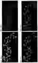 Fig. 56 - Methods of using PDX1-positive pancreatic endoderm cells and endocrine precursor cells
