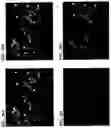 Fig. 57 - Methods of using PDX1-positive pancreatic endoderm cells and endocrine precursor cells