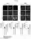 Fig. 07 - HUMAN INTESTINAL EPITHELIUM MODEL AND METHOD FOR PREPARING SAME