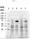 Fig. 05 - Reverse Transcriptase Mutants with Increased Activity and Thermostability