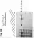Fig. 101 - CLASS 2 CRISPR-CAS RNA-GUIDED ENDONUCLEASES