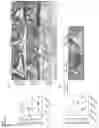 Fig. 11 - NUCLEIC ACIDS FOR INHIBITING EXPRESSION OF PROS1 IN A CELL