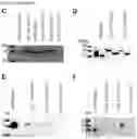 Fig. 13 - NUCLEIC ACIDS FOR INHIBITING EXPRESSION OF PROS1 IN A CELL