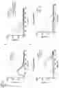 Fig. 17 - NUCLEIC ACIDS FOR INHIBITING EXPRESSION OF PROS1 IN A CELL