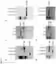 Fig. 18 - NUCLEIC ACIDS FOR INHIBITING EXPRESSION OF PROS1 IN A CELL
