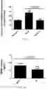 Fig. 07 - INHIBITION OF LET7I AS A MEANS TO ENHANCE THE PROTECTIVE EFFECT OF PROGESTERONE AGAINST STROKE