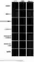Fig. 09 - INHIBITION OF LET7I AS A MEANS TO ENHANCE THE PROTECTIVE EFFECT OF PROGESTERONE AGAINST STROKE