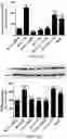 Fig. 10 - INHIBITION OF LET7I AS A MEANS TO ENHANCE THE PROTECTIVE EFFECT OF PROGESTERONE AGAINST STROKE