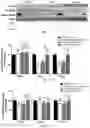 Fig. 11 - INHIBITION OF LET7I AS A MEANS TO ENHANCE THE PROTECTIVE EFFECT OF PROGESTERONE AGAINST STROKE