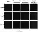 Fig. 15 - INHIBITION OF LET7I AS A MEANS TO ENHANCE THE PROTECTIVE EFFECT OF PROGESTERONE AGAINST STROKE