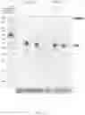 Fig. 17 - CRISPR-CAS COMPONENT SYSTEMS, METHODS AND COMPOSITIONS FOR SEQUENCE MANIPULATION