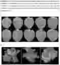 Fig. 04 - SUPPRESSION OF TARGET GENE EXPRESSION THROUGH GENOME EDITING OF NATIVE MIRNAS