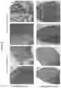 Fig. 13 - Pathogen resistance in plants