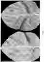 Fig. 13 - POTYVIRUS RESISTANCE GENES AND METHODS OF USE