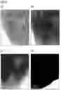 Fig. 05 - METHOD FOR PRODUCING A CORROSION-RESISTANT ALUMINUM-SILICON ALLOY CASTING, SUCH CORROSION-RESISTANT ALUMINUM-SILICON ALLOY CASTING AND ITS USE