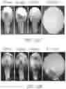 Fig. 11 - Method for manufacturing a polymer-based fibrous scaffold