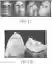 Fig. 12 - Method for manufacturing a polymer-based fibrous scaffold