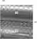 Fig. 01 - APPARATUS AND PROCESS FOR DEFORMING A WEB
