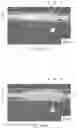 Fig. 09 - APPARATUS AND PROCESS FOR DEFORMING A WEB