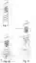 Fig. 04 - No Vibration Stone Column Drill