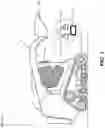 Fig. 02 - Machine control component with input device to control machine display