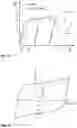 Fig. 08 - Construction damper with at least one at least in regions ladder-like constructed thrust damping part