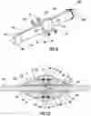 Fig. 07 - Wireline standoff