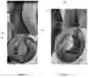 Fig. 04 - Locking shackle and pin