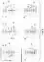 Fig. 09 - Power transmission device