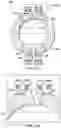 Fig. 15 - Wear inserts for well service reactive dampeners