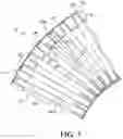 Fig. 05 - Methods of preventing failure of corrugated tube in type IV pressure vessels