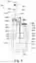 Fig. 05 - System for accessing biological samples in a cryogenic Dewar vessel