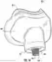 Fig. 30 - Apparatuses, systems, and methods for sample capture and extraction