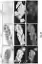 Fig. 14 - SYSTEMS AND METHODS FOR ASSESSING SPECIMEN FIXATION DURATION AND QUALITY USING VIBRATIONAL SPECTROSCOPY