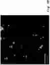 Fig. 10 - Method for the detection and quantification of nano or micro plastic particles