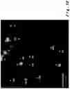 Fig. 12 - Method for the detection and quantification of nano or micro plastic particles
