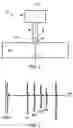 Fig. 02 - ULTRASOUND METHOD AND APPARATUS