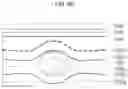 Fig. 05 - Battery defect screening device and method