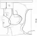 Fig. 10 - MRI systems and receive coil arrangements