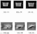 Fig. 05 - Magnetic resonance imaging method and system for subject with metal implants