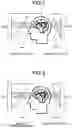 Fig. 03 - Magnetic resonance imaging apparatus, imaging parameter determining method, and non-volatile computer-readable storage medium storing therein imaging parameter determining program