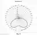 Fig. 12 - Single edge lit lighting module with bi-lobed light distribution