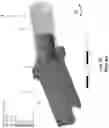 Fig. 06 - Two-piece spring push with stress distribution features