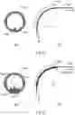 Fig. 07 - Fibre optic cable, methods of manufacture and use thereof