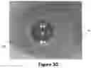Fig. 11 - METHODS AND SYSTEMS FOR PROVIDING LENS FABRICATION DESIGN CAPABLE OF COMPENSATING FOR HIGHER ORDER ABERRATIONS