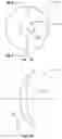 Fig. 02 - Ophthalmic lens including a peripheral zone having an add-power offset and a spatially-modulated optical parameter