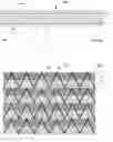 Fig. 02 - Array substrate, dimming liquid crystal panel, and display panel