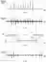 Fig. 03 - Audio signal processing device based on orientation